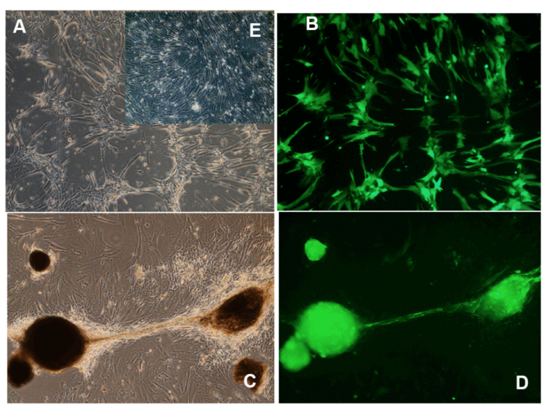 Figure 3. Morphological changes induced by long-term OSKM gene action in human umbilical cord perivascular cells (HUCPVC).