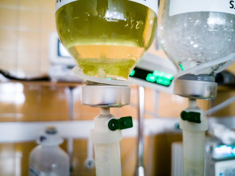 Infusion drips with bottles of yellow albumin fluid.