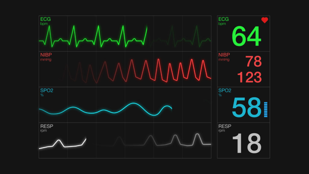 closeup view of an ecg ekg display, heart rate