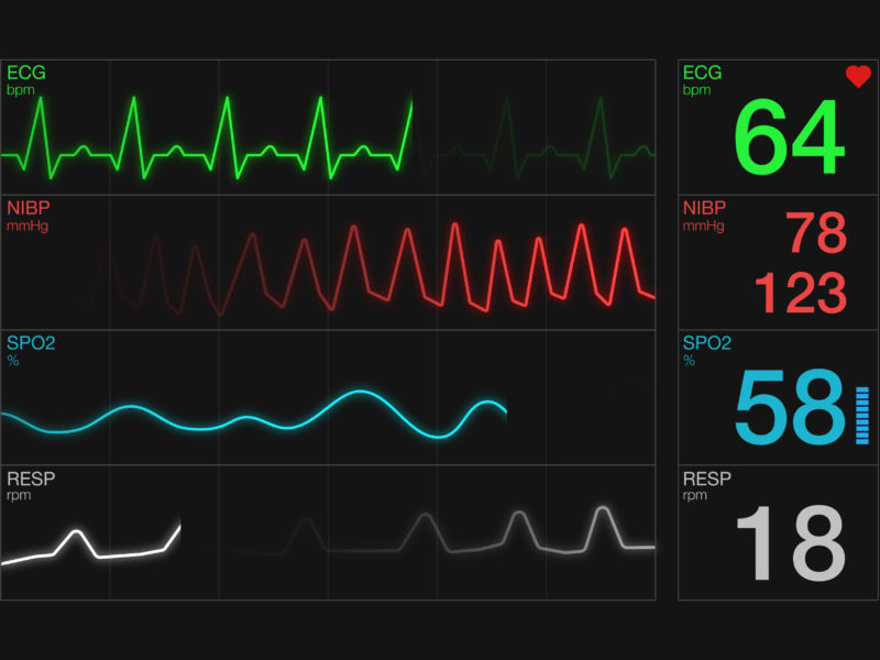 closeup view of an ecg ekg display, heart rate
