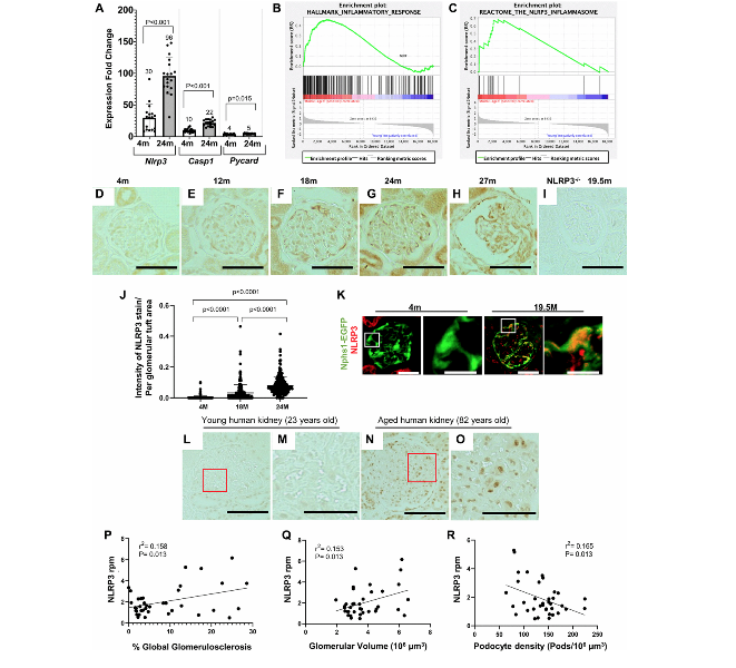 Inhibiting NLRP3 signaling in aging podocytes improves their life- and health-span