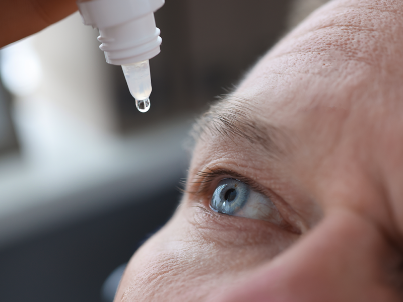 Dry Eyes? It May be Immune Infiltration in Aging Lacrimal Glands