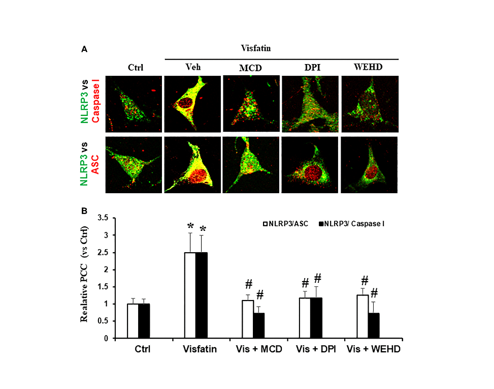 Contribution of membrane raft redox signalling to visfatin-induced inflammasome activation and podocyte injury