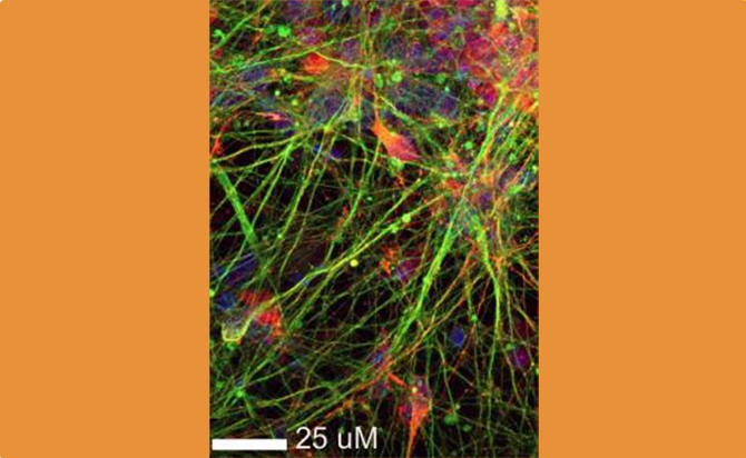 Understanding the Mechanisms of Brain Aging and Longevity in Neurons