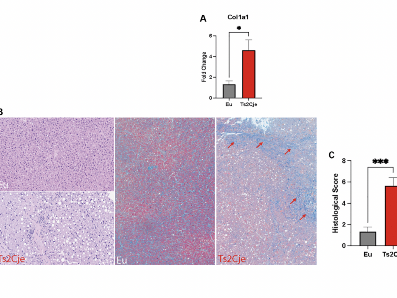 Aging exacerbates oxidative stress and liver fibrosis in an animal model of Down Syndrome