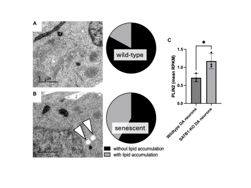 Lipid accumulation drives cellular senescence in dopaminergic neurons