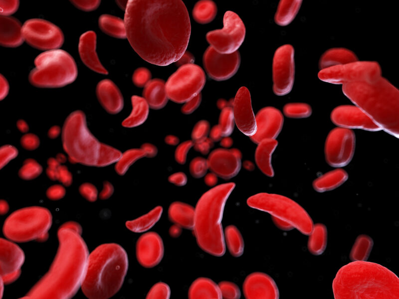 3d rendered medically accurate illustration of sickle cells