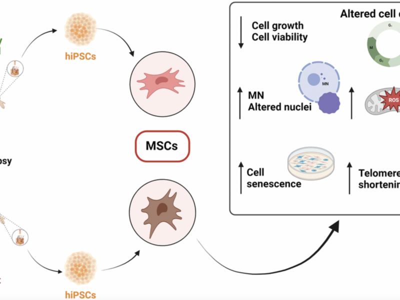 When do the pathological signs become evident? Study of human mesenchymal stem cells in MDPL syndrome