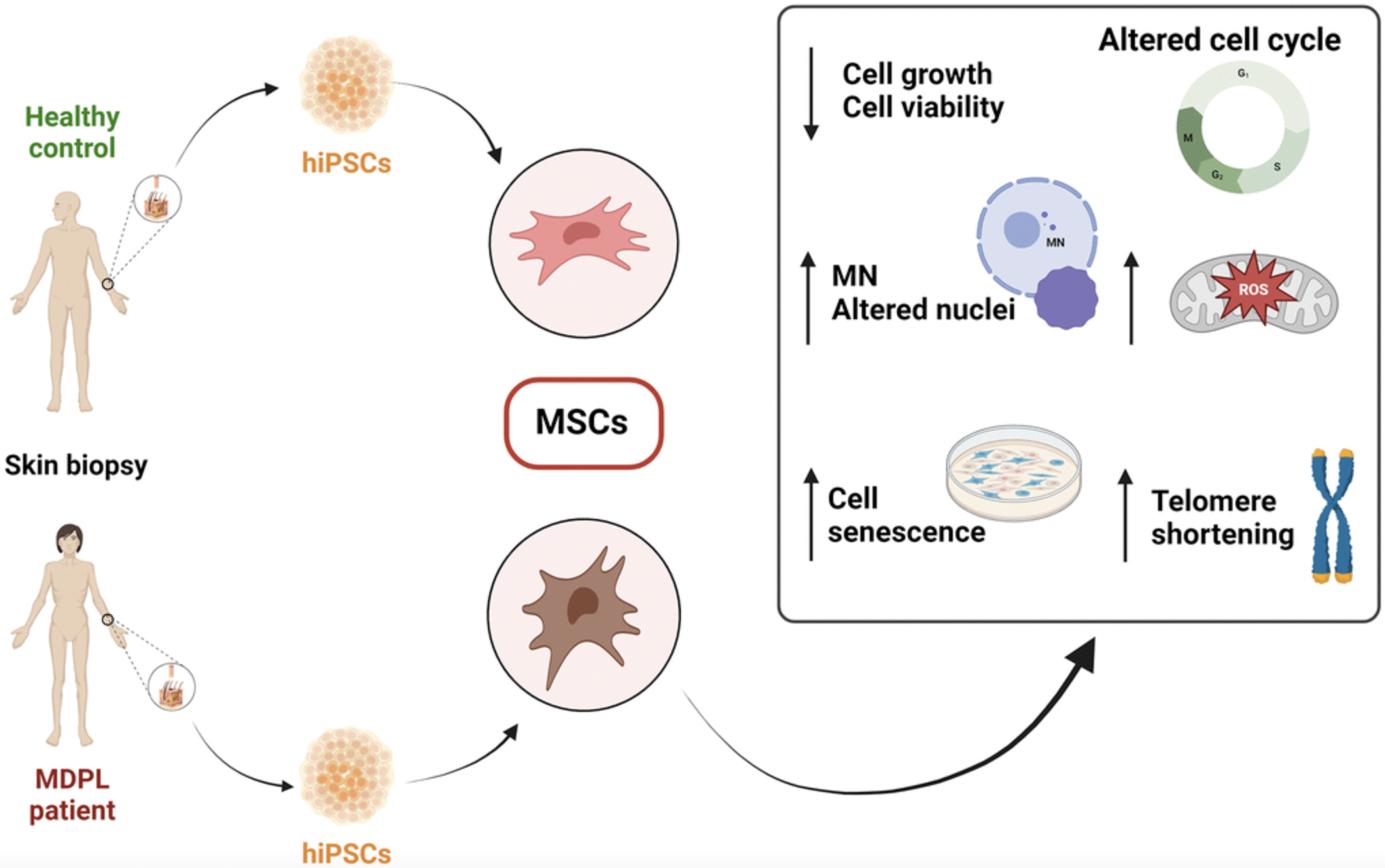 When do the pathological signs become evident? Study of human mesenchymal stem cells in MDPL syndrome