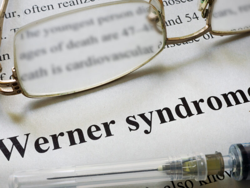 Paper with words Werner syndrome and glasses. Medical concept.