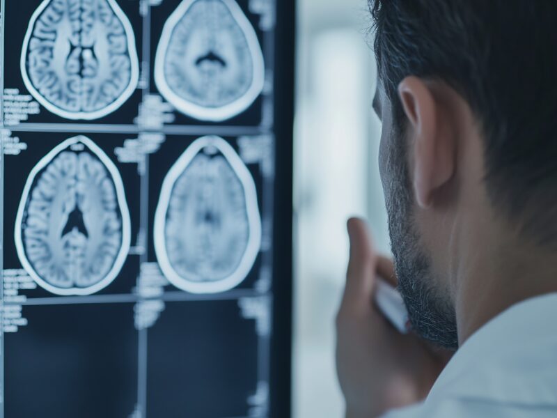 Neuropsychologist specializing Cognitive Rehabilitation assisting patients with brain injuries or neurological disorders to improve cognitive function