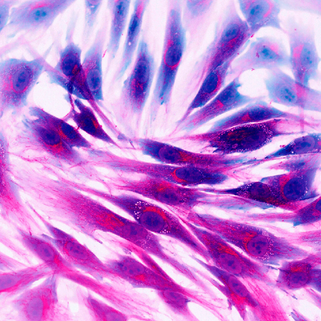 Real fluorescence microscopic view of human skin cells