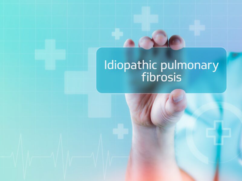 Idiopathic pulmonary fibrosis (IPF). Doctor holds virtual card in hand. Medicine digital