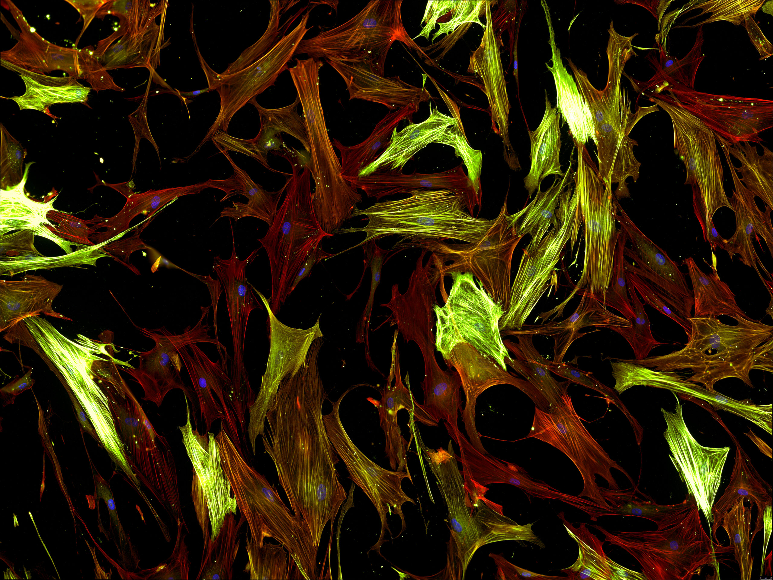 P38 MAPK–Driven Epigenetic Regulation Identified as a Key Mechanism in Lung Fibrosis